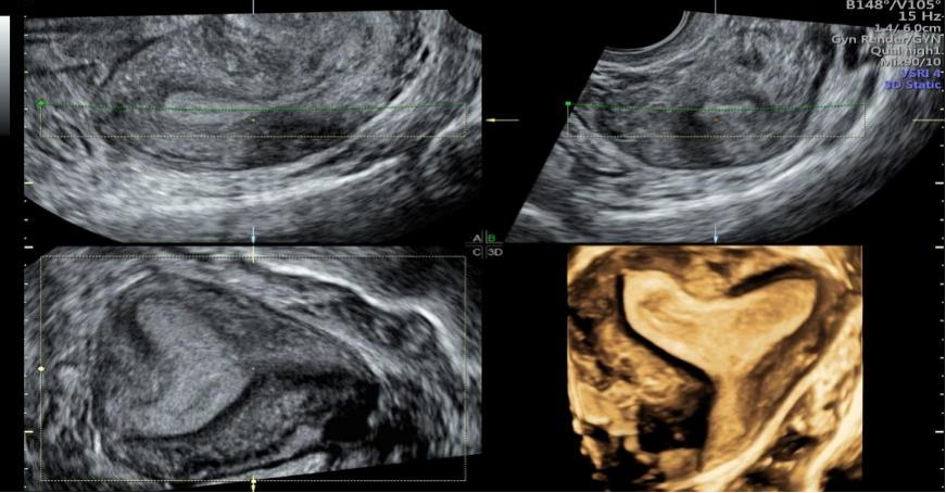 VOlusonE什么彩超机孕妈妈的福音——金普妇幼首家引进高端四维彩超-GE-Voluson金标E10_https://www.jmylbn.com_新闻资讯_第19张