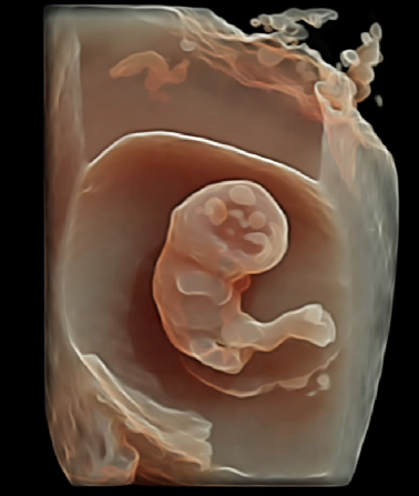 VOlusonE什么彩超机孕妈妈的福音——金普妇幼首家引进高端四维彩超-GE-Voluson金标E10_https://www.jmylbn.com_新闻资讯_第11张