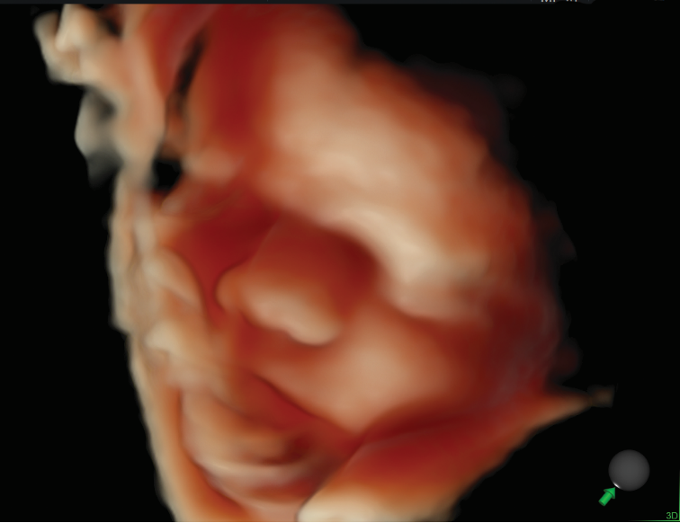 VOlusonE什么彩超机孕妈妈的福音——金普妇幼首家引进高端四维彩超-GE-Voluson金标E10_https://www.jmylbn.com_新闻资讯_第8张