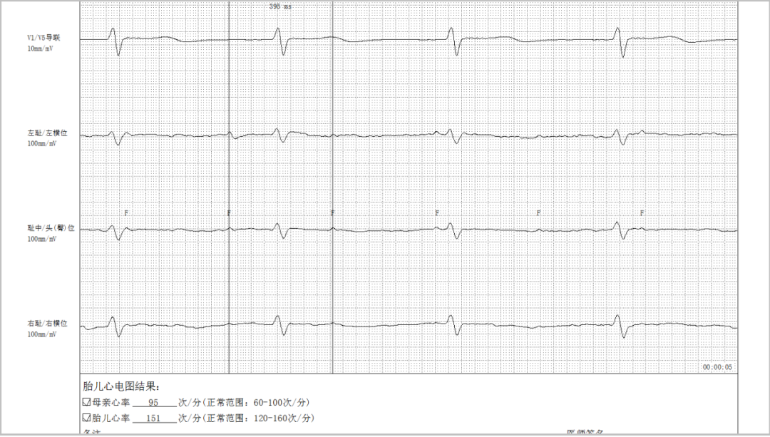 胎儿心电图是什么意思在妈妈肚子里也可以做宝宝的心电图吗？_https://www.jmylbn.com_新闻资讯_第2张