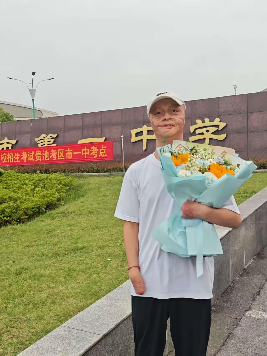 男生因病请假一学期高考逆袭669分,今日聚焦：双拳抱笔艰难书写，高考664分！烧伤男孩..