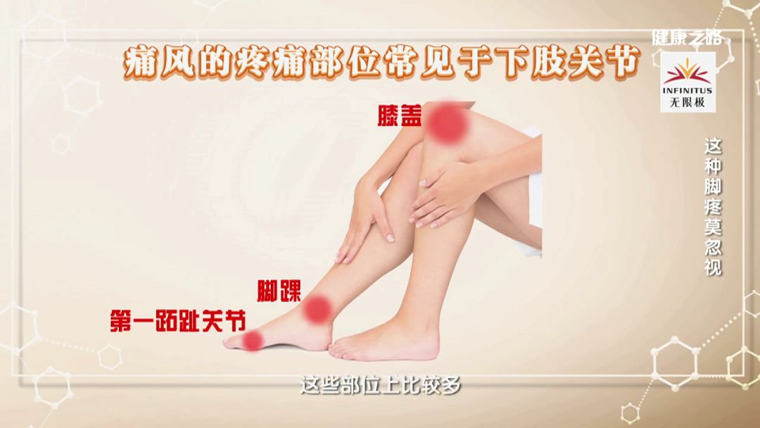 男性比女性更容易得痛風！痛久了還可能得尿毒症！| 健康之路 健康 第5張