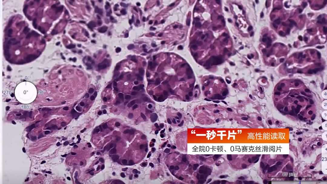 当 AI 成为显微镜的瞳孔，病理科迎来“超分辨率”时刻