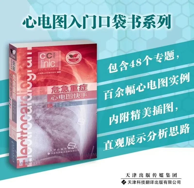 心电图器怎么用起搏器入门，简单易懂！_https://www.jmylbn.com_新闻资讯_第62张