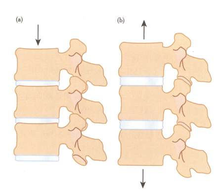怎么选择家用颈椎牵引在家“吊脖子”治颈椎病，真的靠谱吗？_https://www.jmylbn.com_新闻资讯_第4张