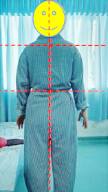 悬吊训练系统 怎么装椎间盘突出引发脊柱侧弯问题，如何通过针灸推拿+悬吊训练恢复身体平衡？_https://www.jmylbn.com_新闻资讯_第5张