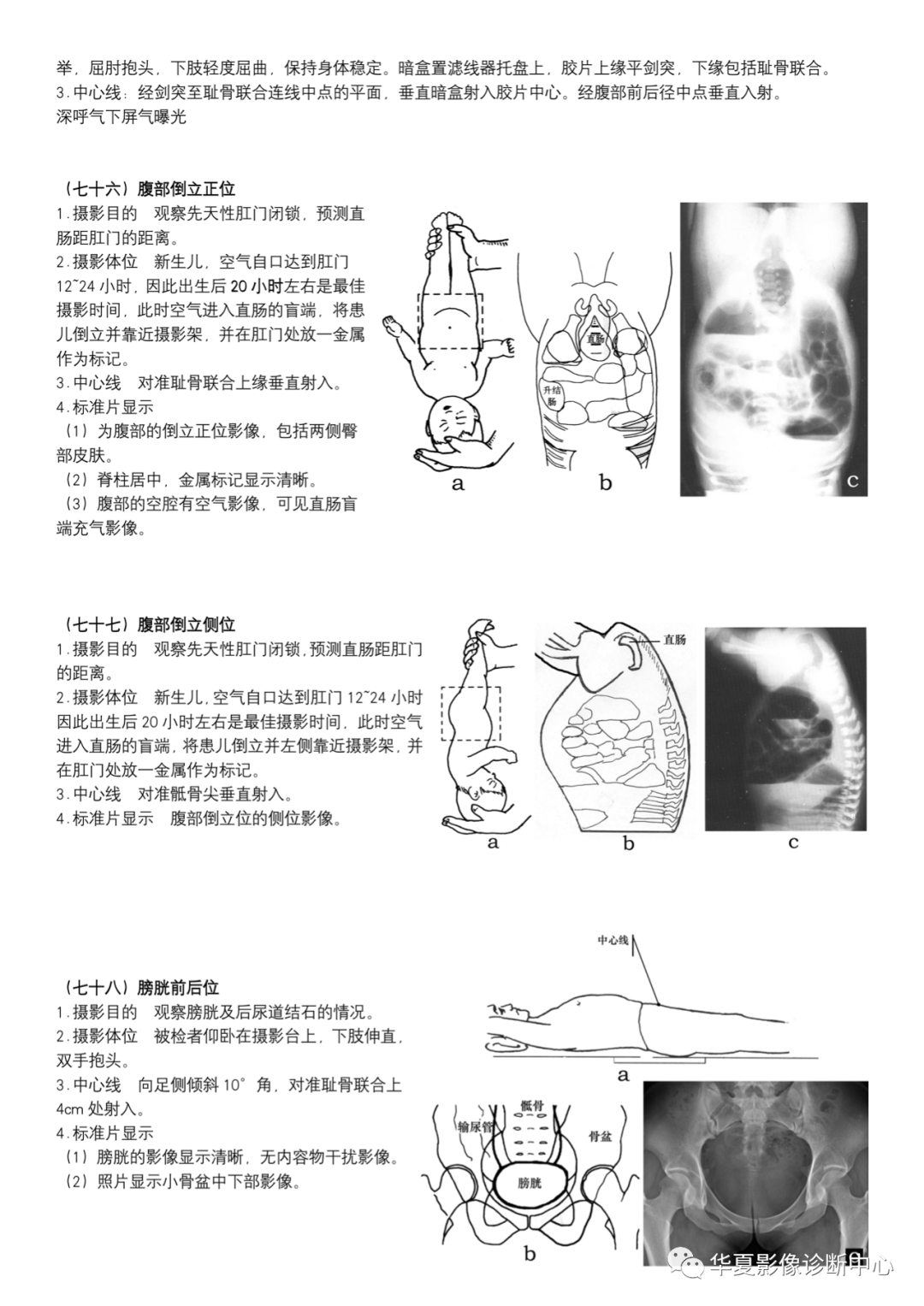 dr摄影是什么DR摄影_https://www.jmylbn.com_新闻资讯_第28张