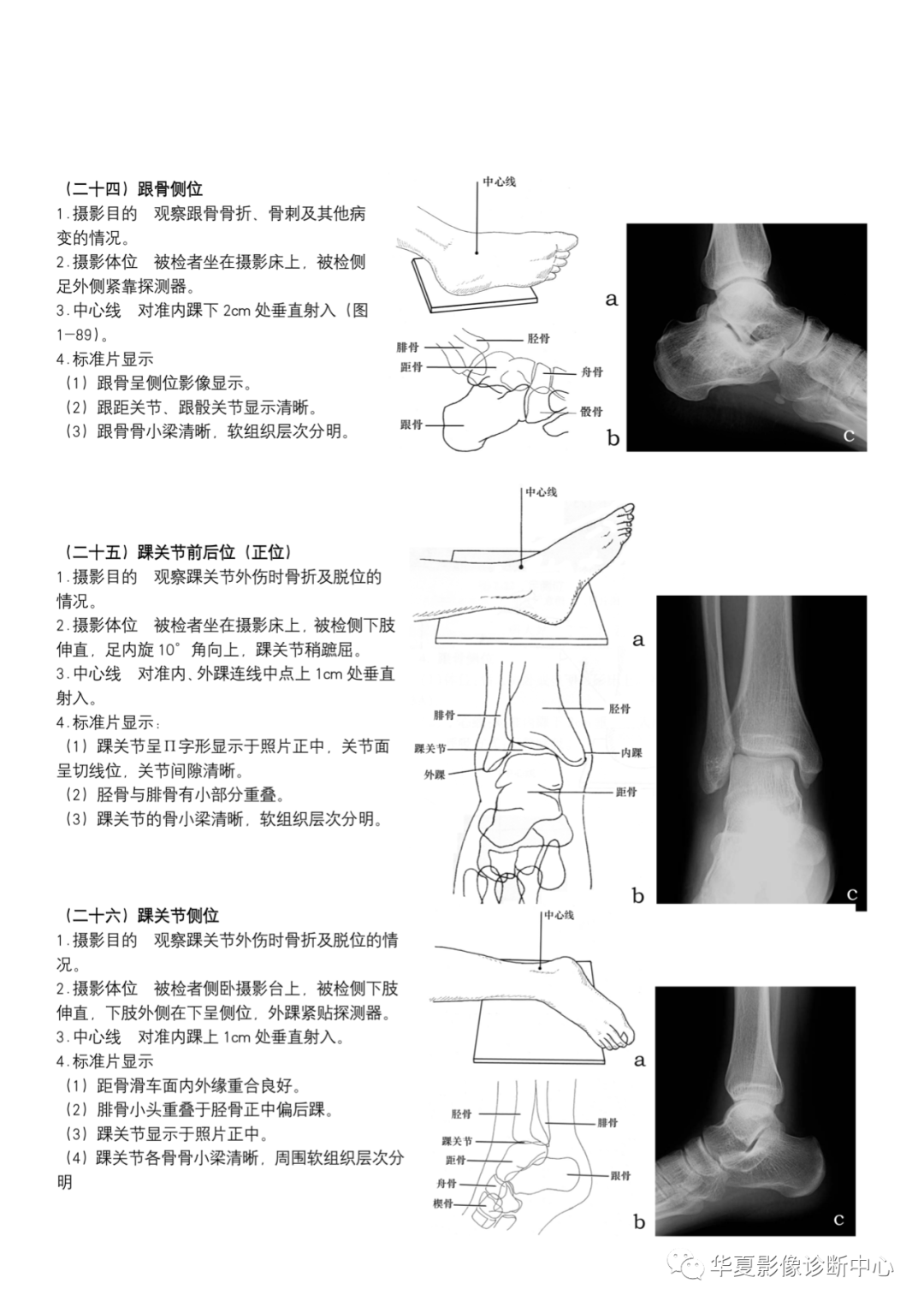 dr摄影是什么DR摄影_https://www.jmylbn.com_新闻资讯_第10张