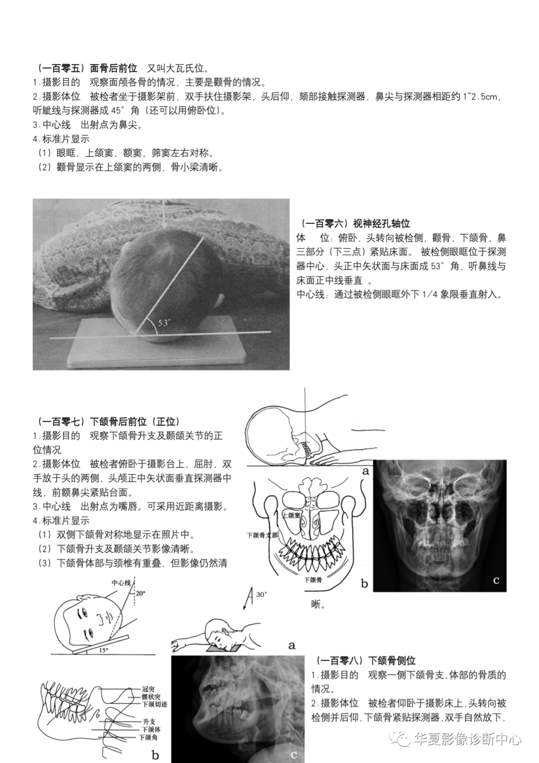 dr摄影是什么DR摄影_https://www.jmylbn.com_新闻资讯_第38张