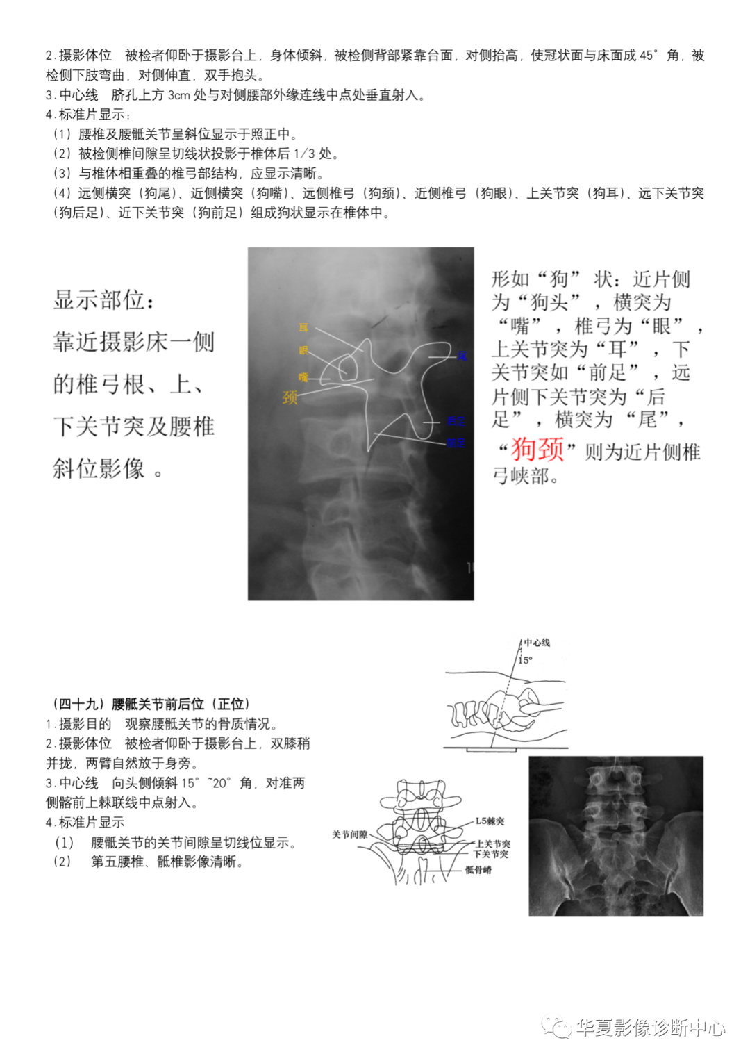 dr摄影是什么DR摄影_https://www.jmylbn.com_新闻资讯_第18张