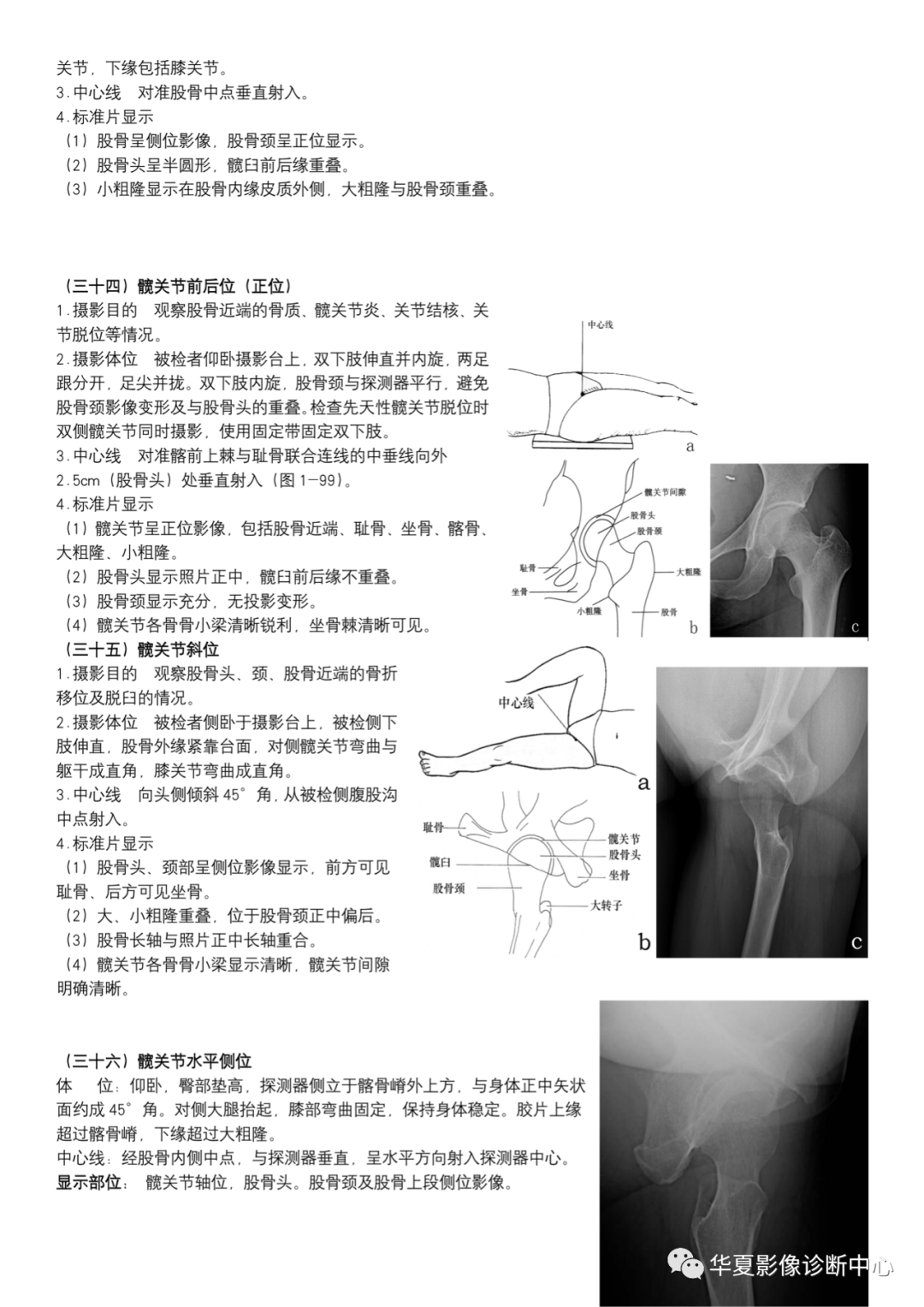 dr摄影是什么DR摄影_https://www.jmylbn.com_新闻资讯_第13张
