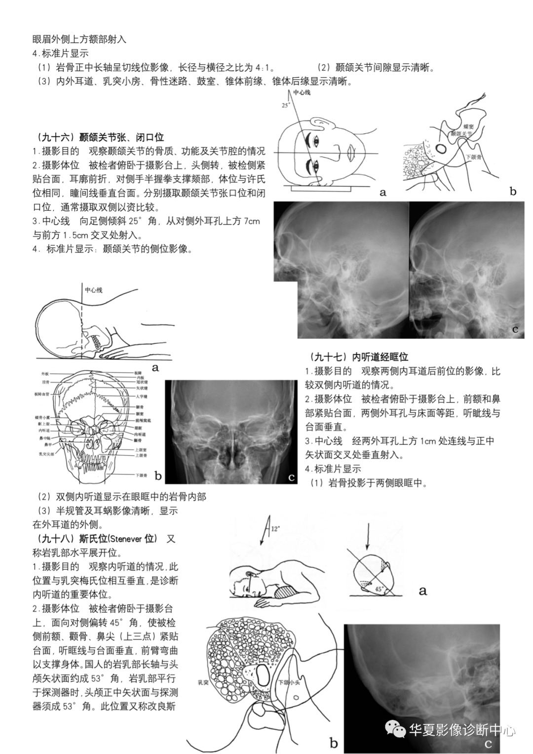 dr摄影是什么DR摄影_https://www.jmylbn.com_新闻资讯_第35张