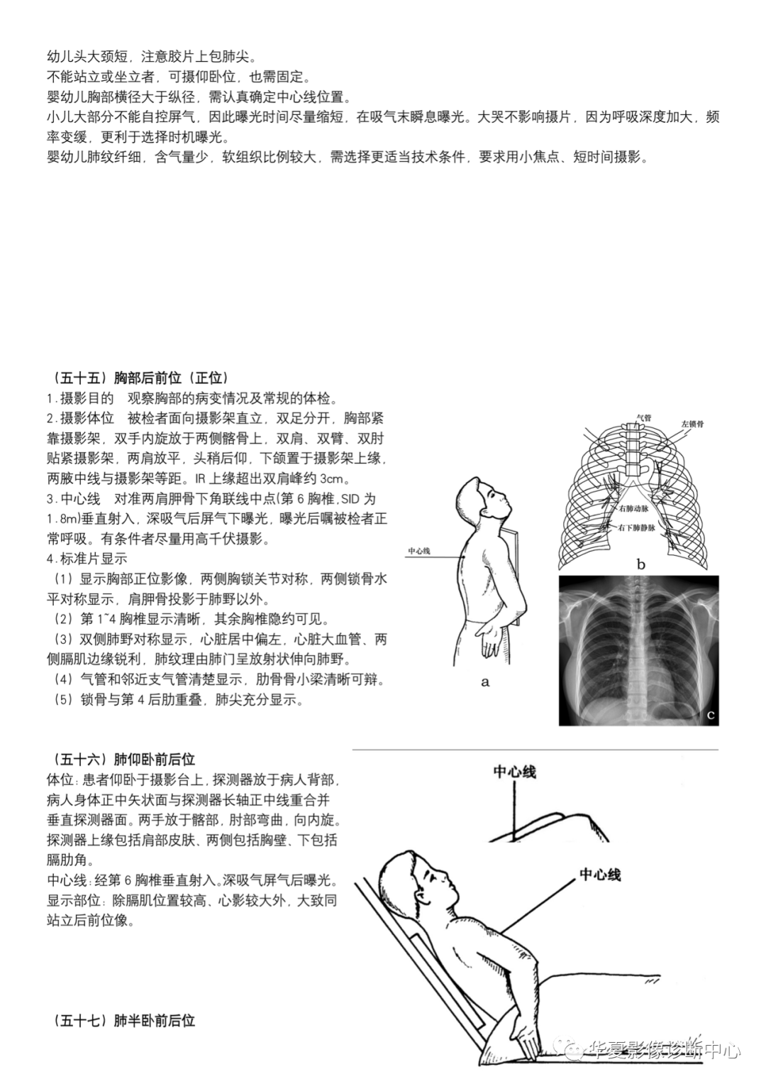 dr摄影是什么DR摄影_https://www.jmylbn.com_新闻资讯_第21张