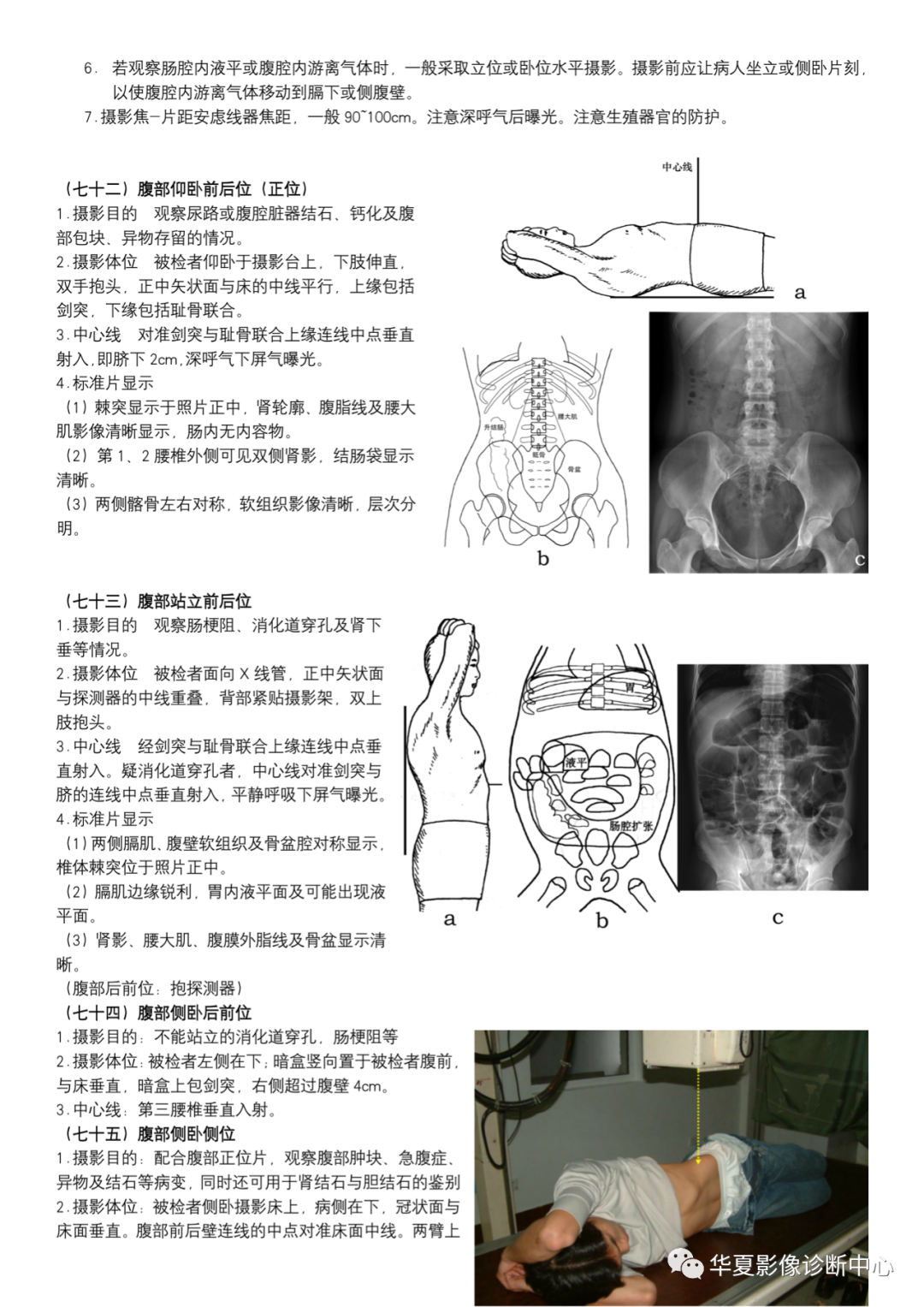 dr摄影是什么DR摄影_https://www.jmylbn.com_新闻资讯_第27张