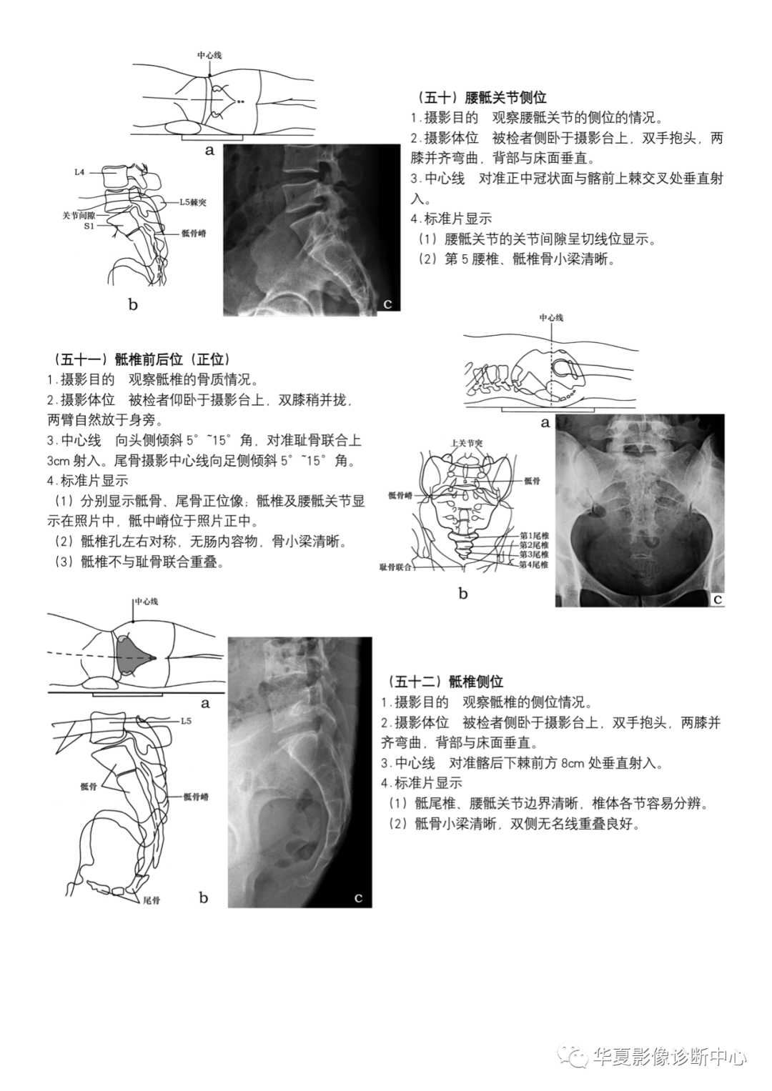 dr摄影是什么DR摄影_https://www.jmylbn.com_新闻资讯_第19张