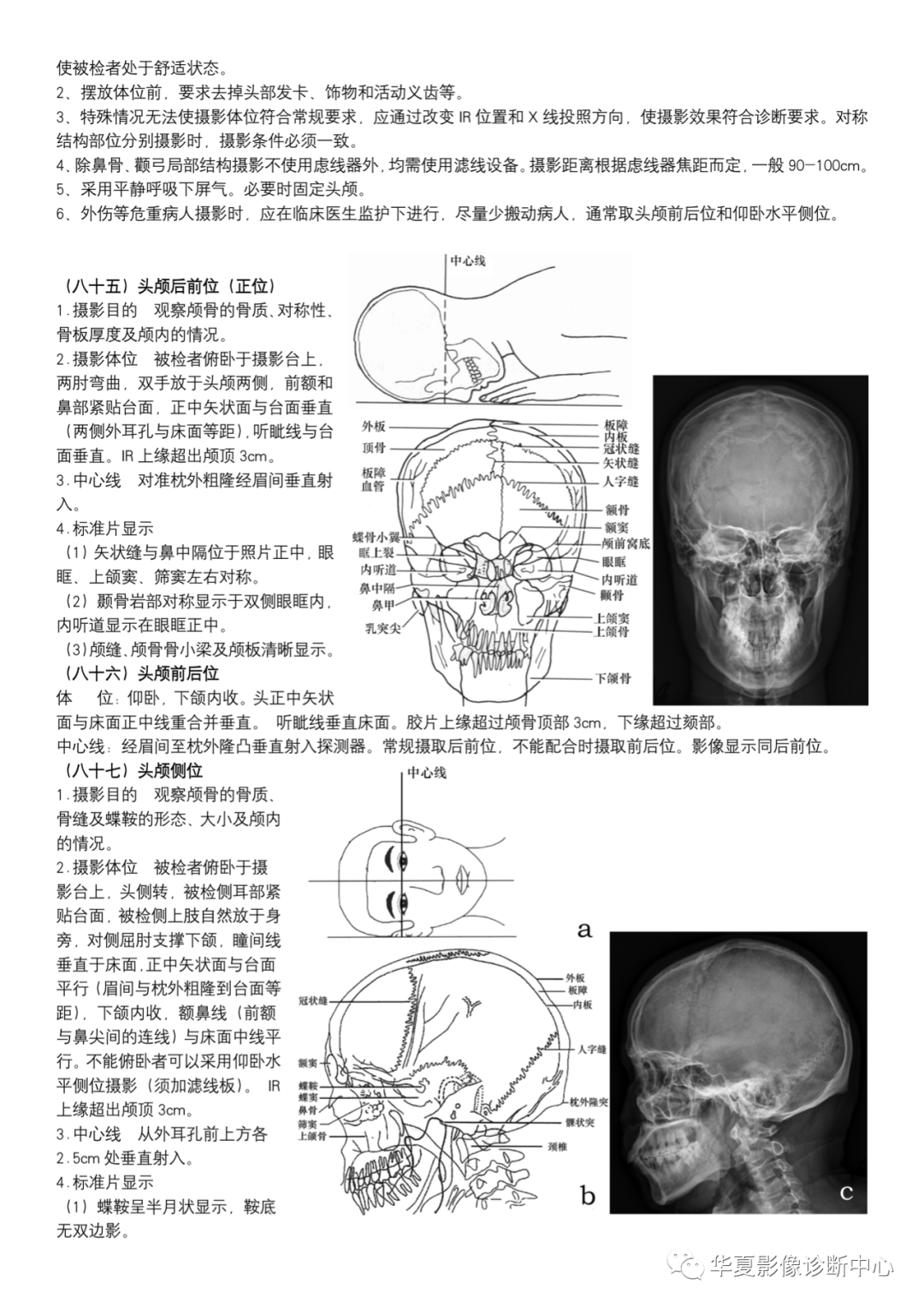 dr摄影是什么DR摄影_https://www.jmylbn.com_新闻资讯_第31张