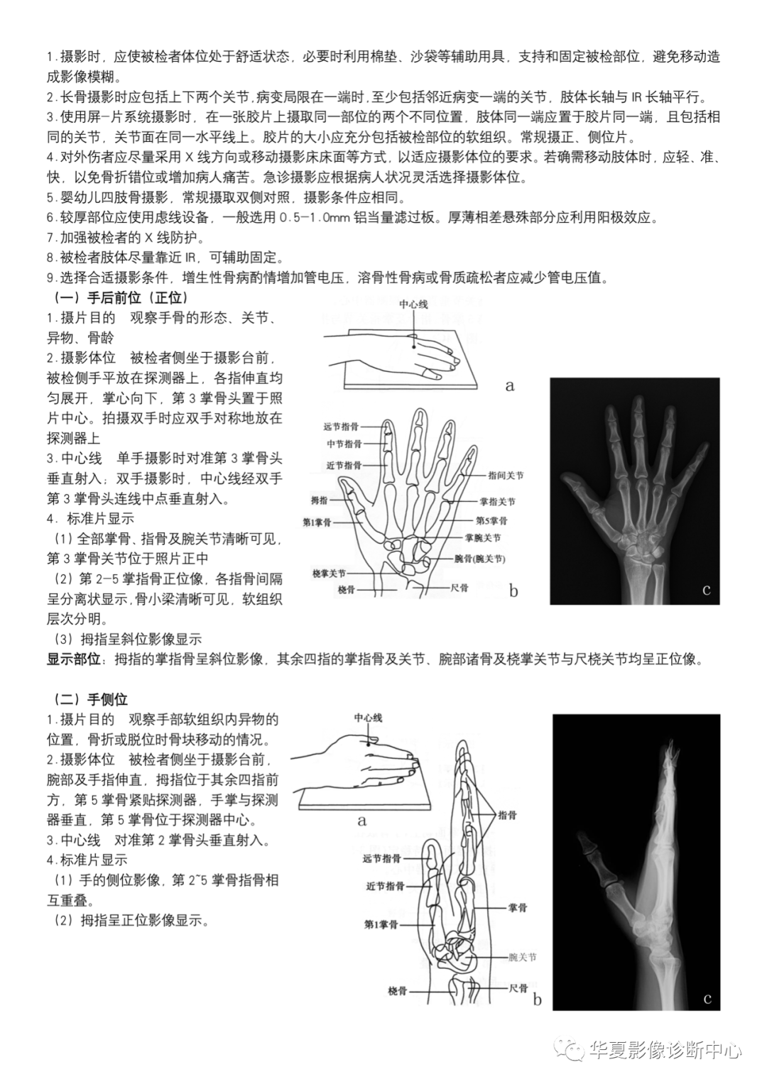 dr摄影是什么DR摄影_https://www.jmylbn.com_新闻资讯_第2张