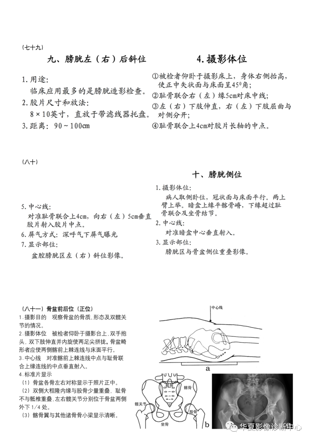 dr摄影是什么DR摄影_https://www.jmylbn.com_新闻资讯_第29张