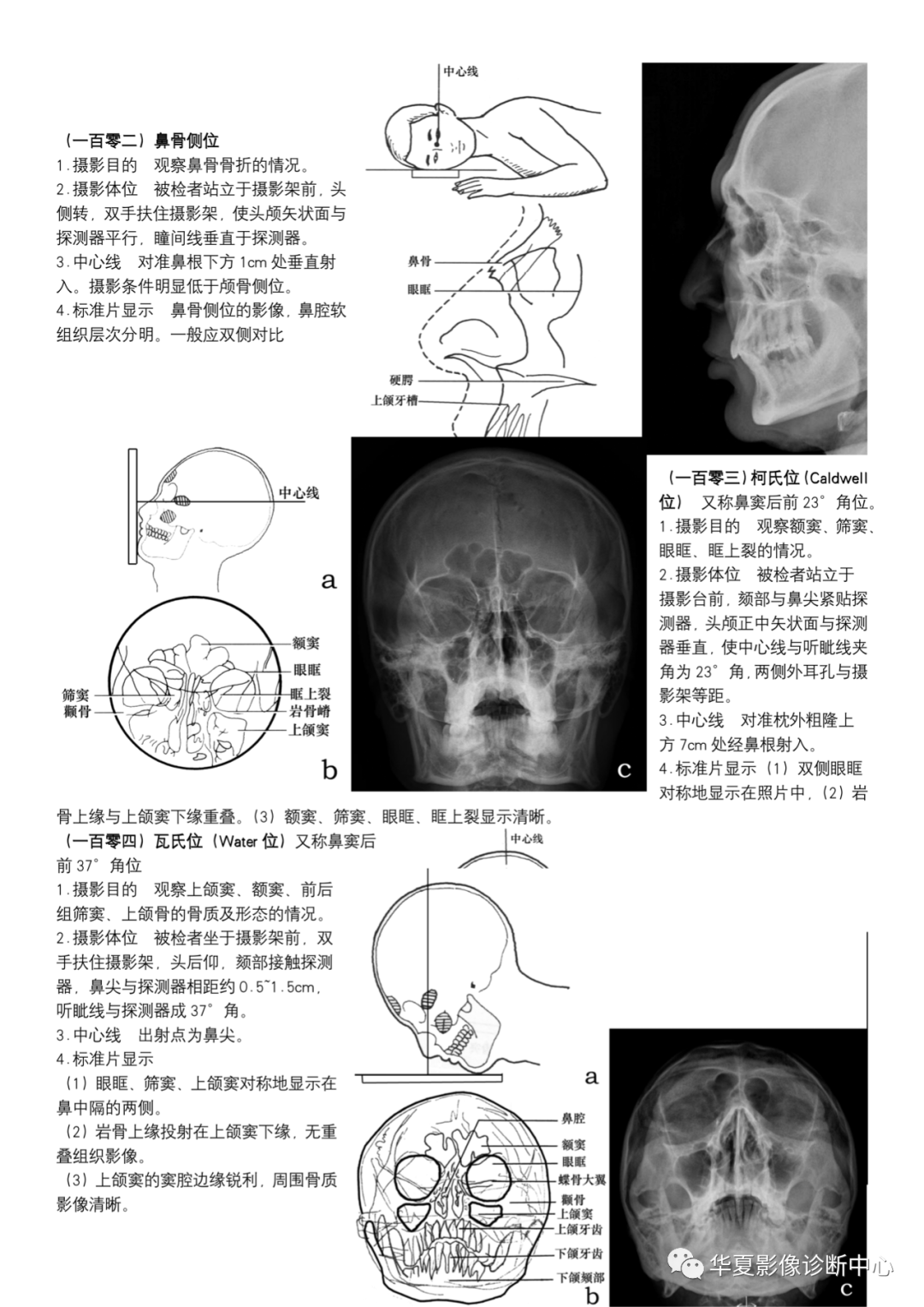 dr摄影是什么DR摄影_https://www.jmylbn.com_新闻资讯_第37张