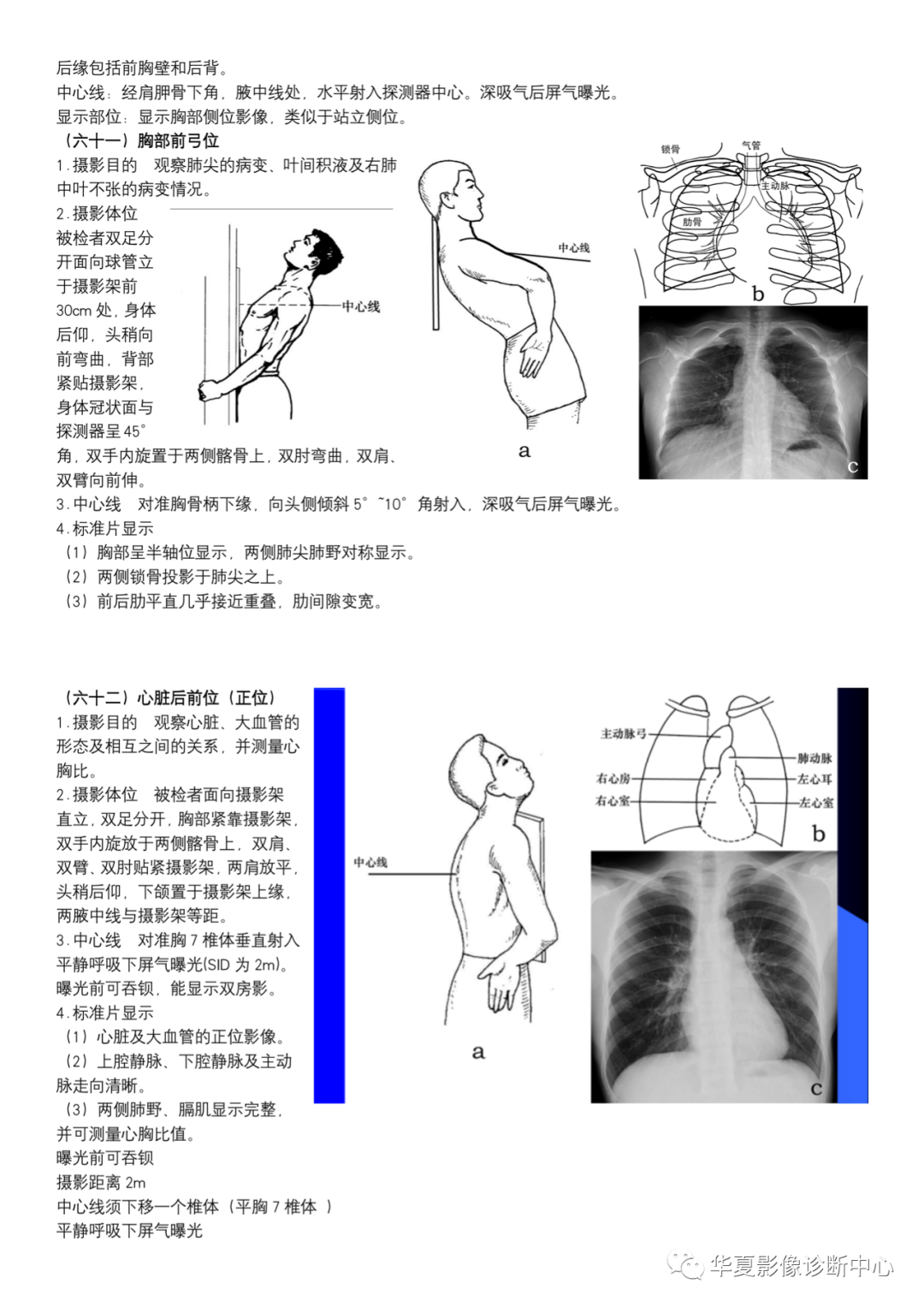 dr摄影是什么DR摄影_https://www.jmylbn.com_新闻资讯_第23张