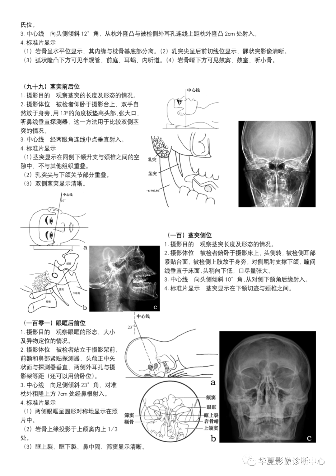 dr摄影是什么DR摄影_https://www.jmylbn.com_新闻资讯_第36张