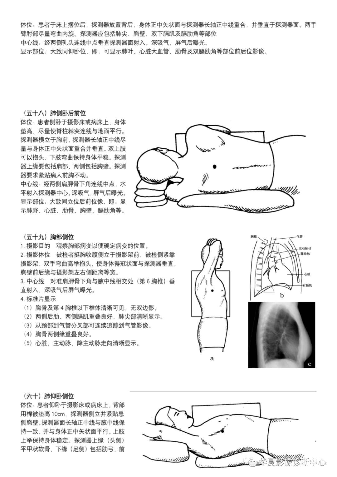 dr摄影是什么DR摄影_https://www.jmylbn.com_新闻资讯_第22张