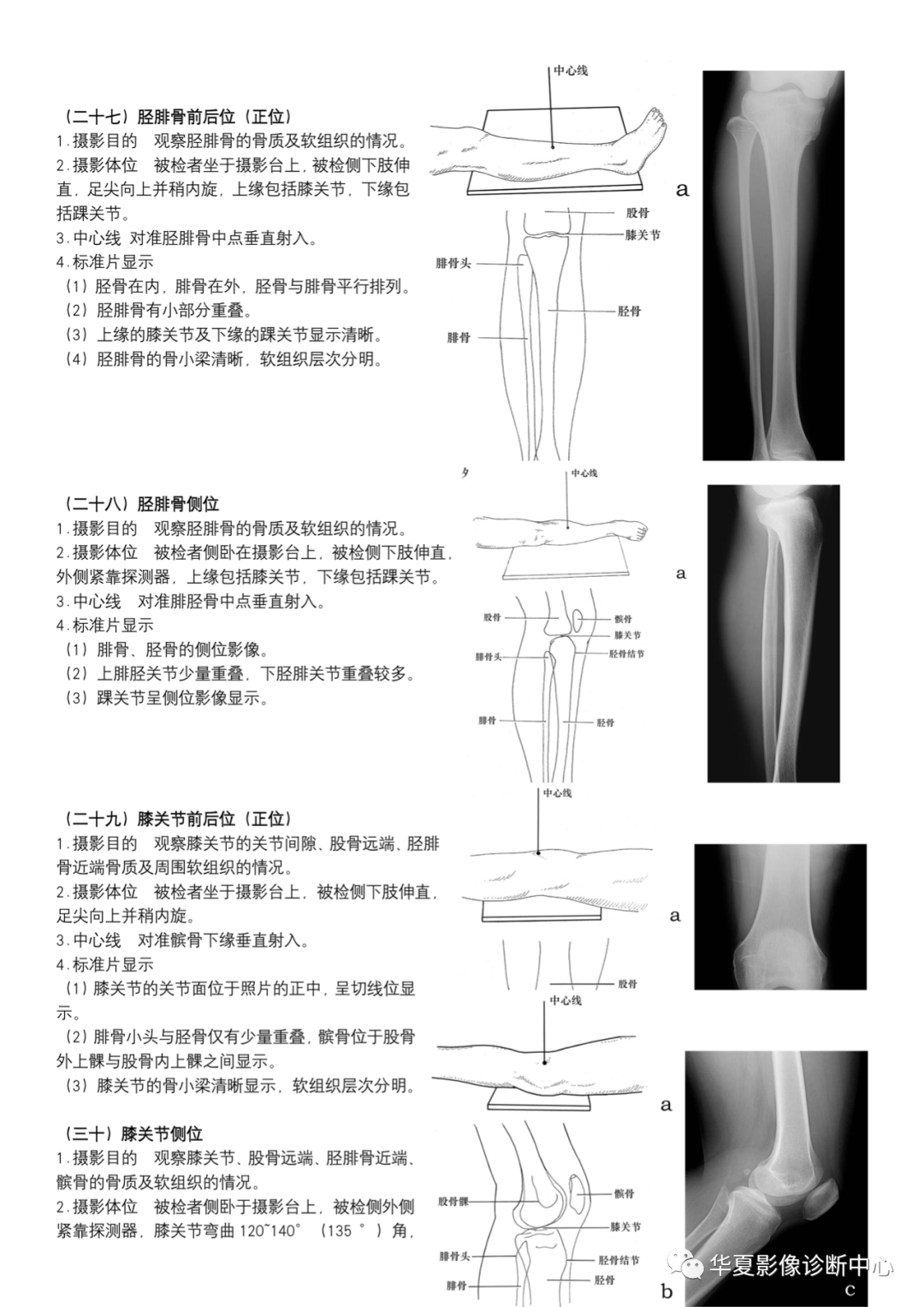 dr摄影是什么DR摄影_https://www.jmylbn.com_新闻资讯_第11张