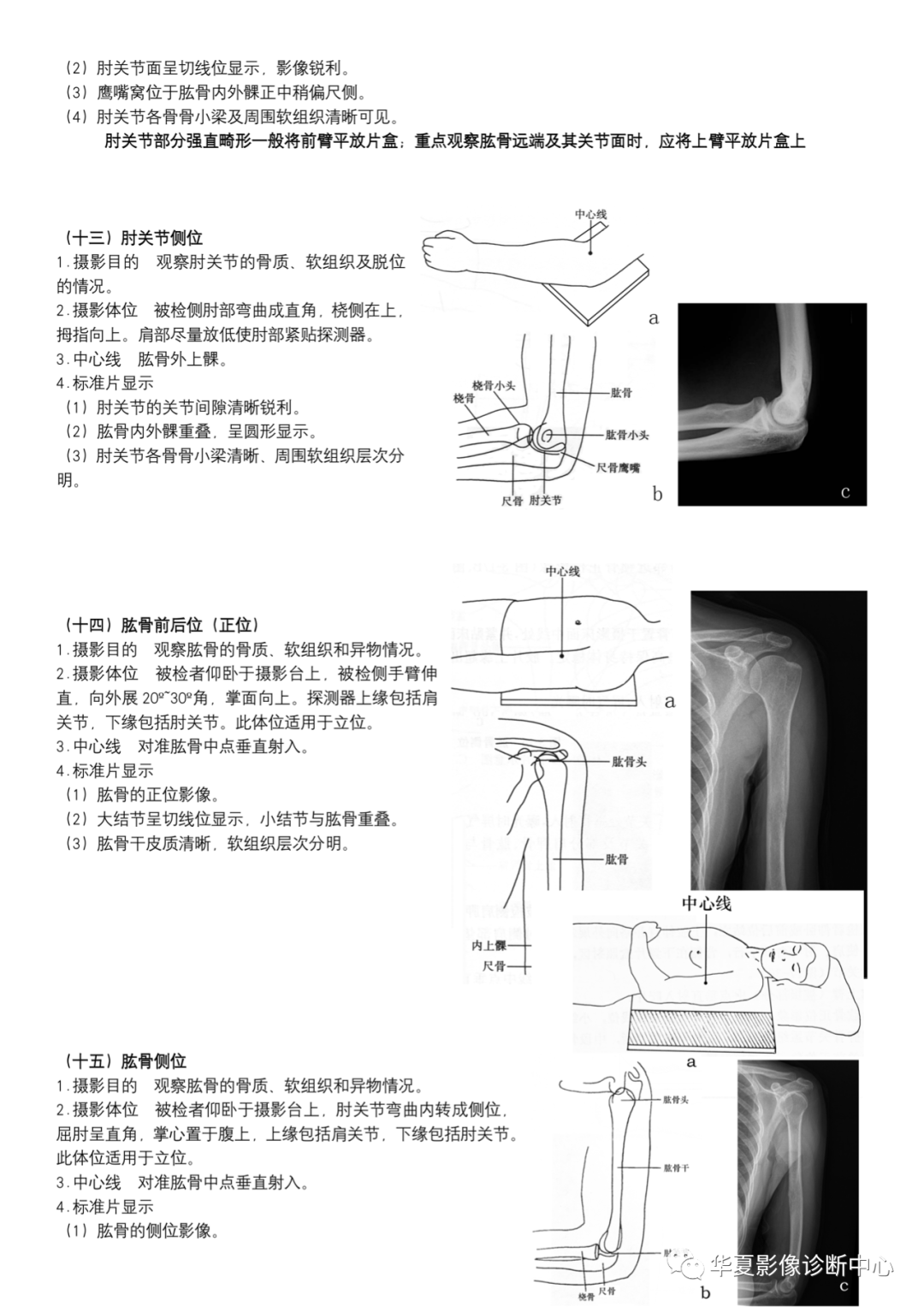 dr摄影是什么DR摄影_https://www.jmylbn.com_新闻资讯_第6张