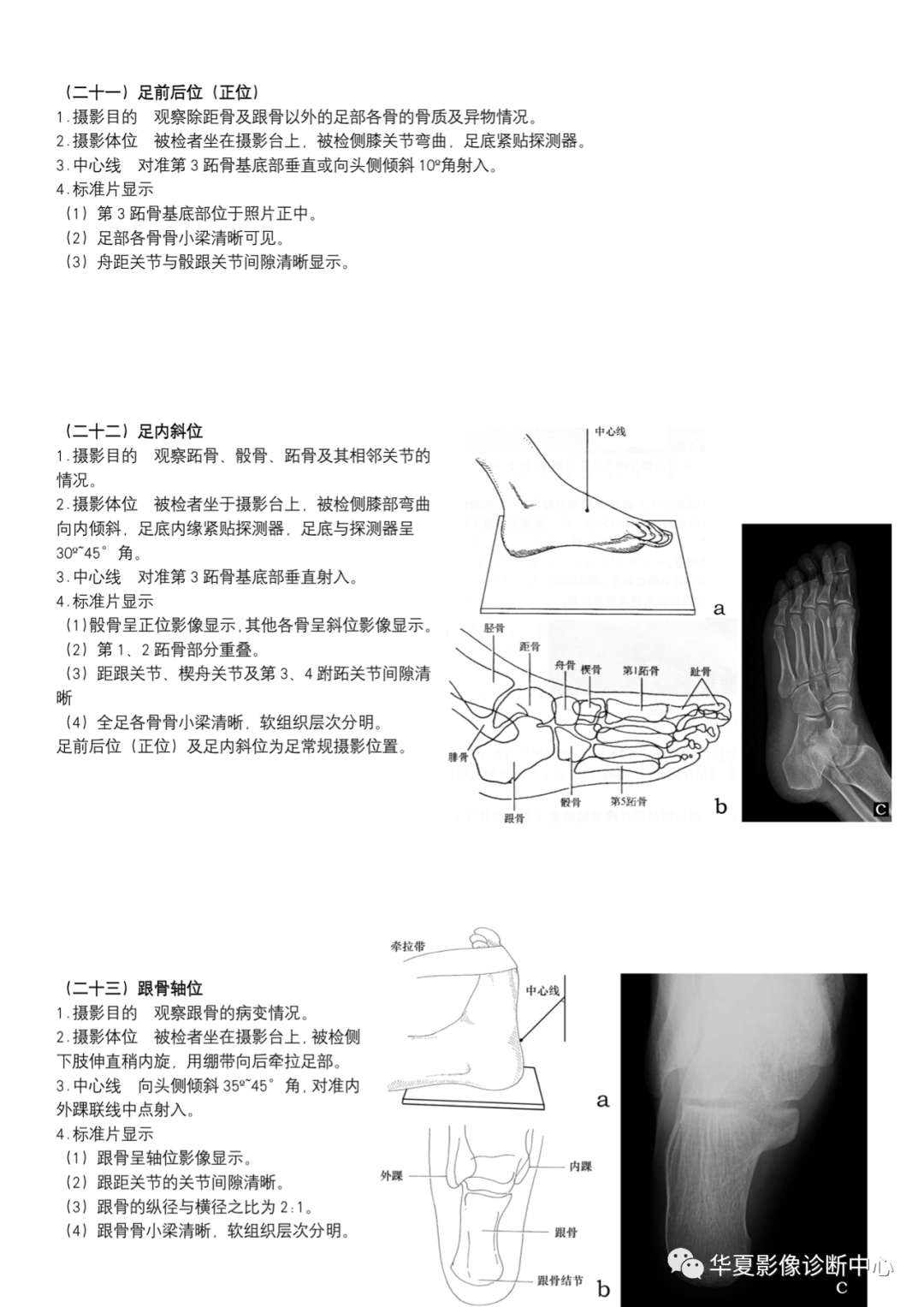 dr摄影是什么DR摄影_https://www.jmylbn.com_新闻资讯_第9张
