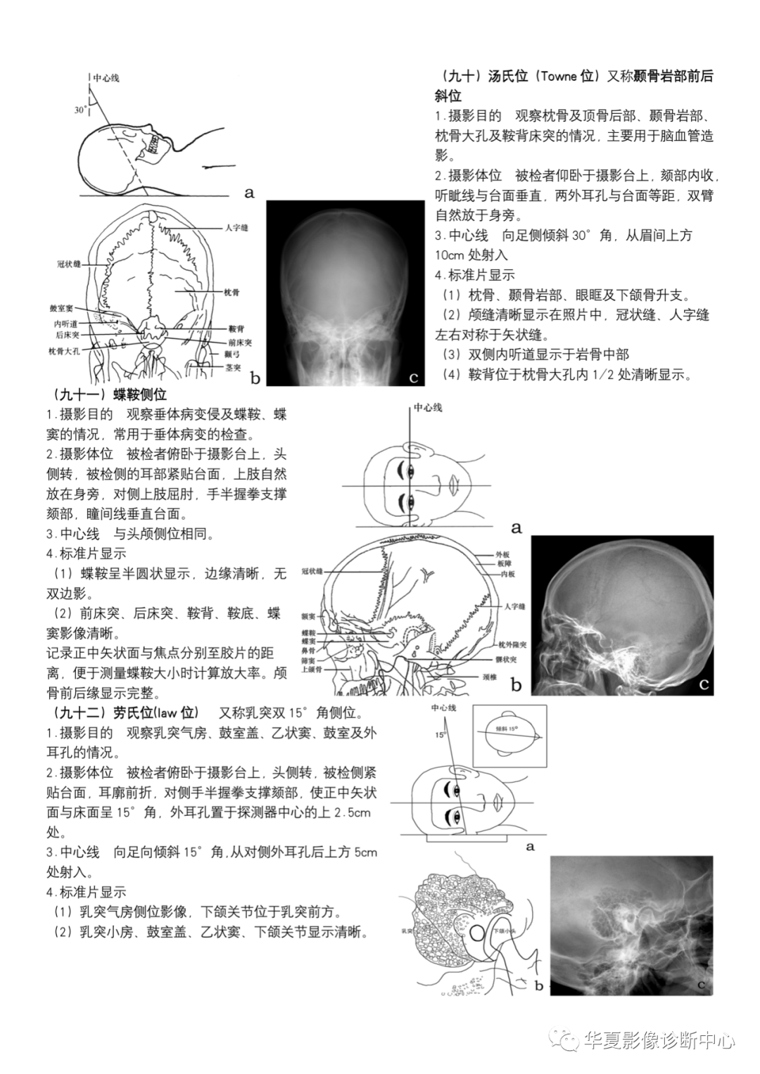 dr摄影是什么DR摄影_https://www.jmylbn.com_新闻资讯_第33张