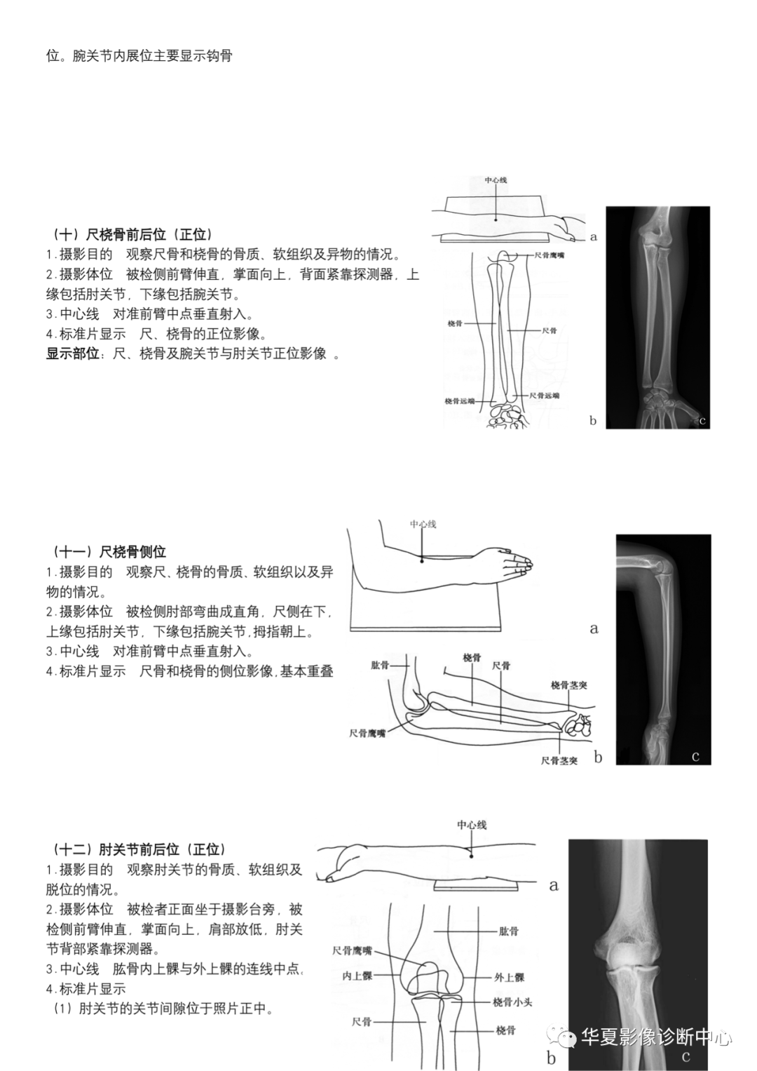 dr摄影是什么DR摄影_https://www.jmylbn.com_新闻资讯_第5张