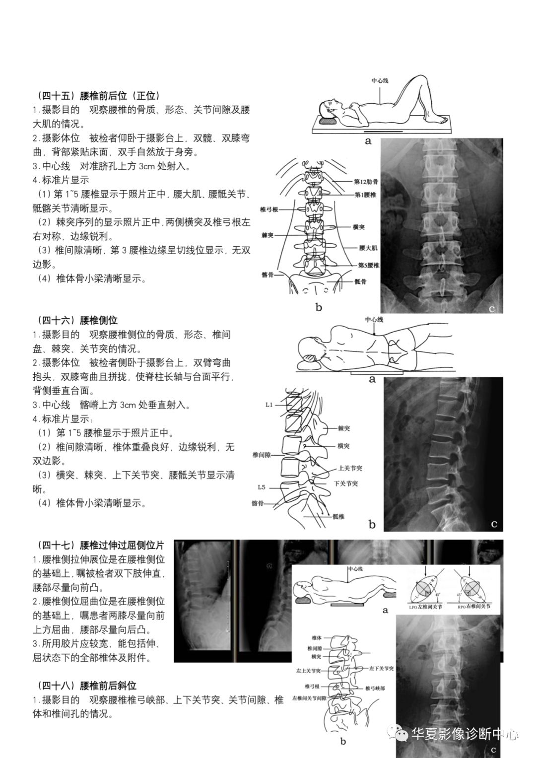 dr摄影是什么DR摄影_https://www.jmylbn.com_新闻资讯_第17张
