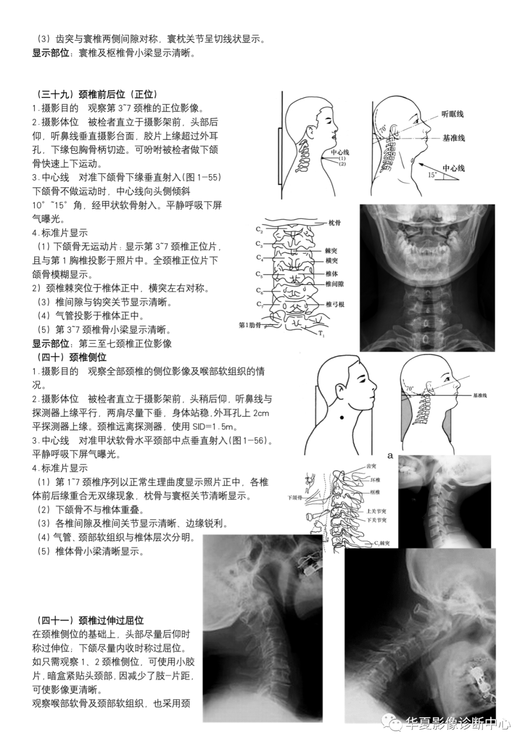 dr摄影是什么DR摄影_https://www.jmylbn.com_新闻资讯_第15张