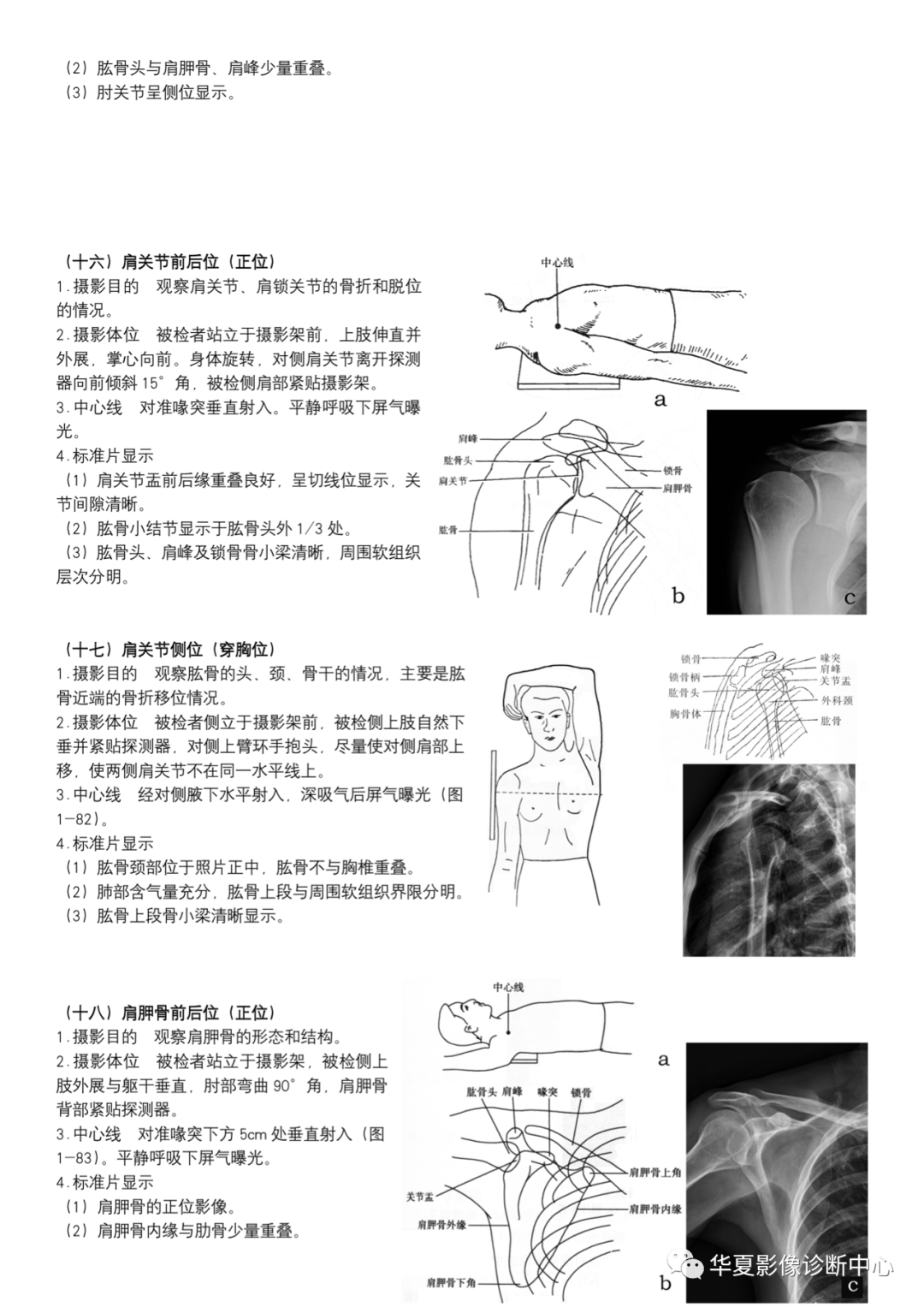 dr摄影是什么DR摄影_https://www.jmylbn.com_新闻资讯_第7张