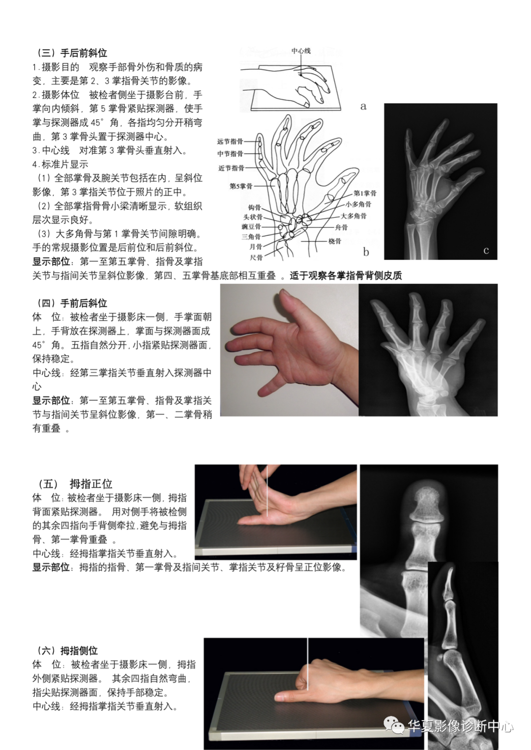 dr摄影是什么DR摄影_https://www.jmylbn.com_新闻资讯_第3张