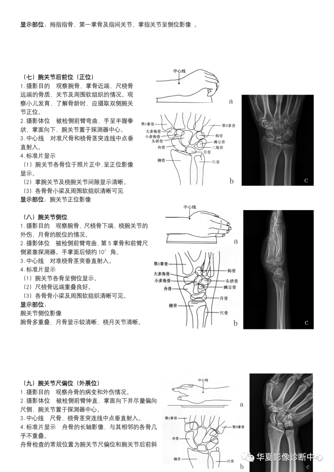 dr摄影是什么DR摄影_https://www.jmylbn.com_新闻资讯_第4张