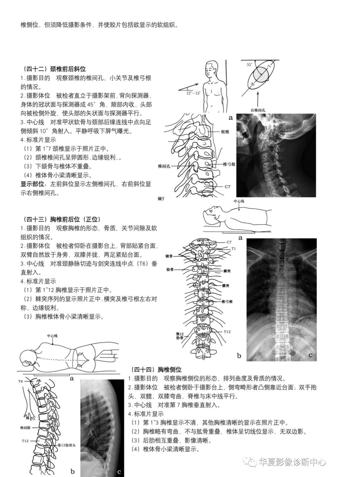 dr摄影是什么DR摄影_https://www.jmylbn.com_新闻资讯_第16张