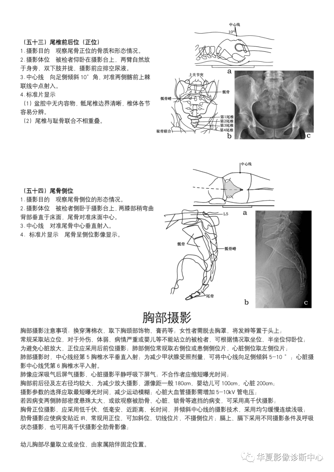 dr摄影是什么DR摄影_https://www.jmylbn.com_新闻资讯_第20张