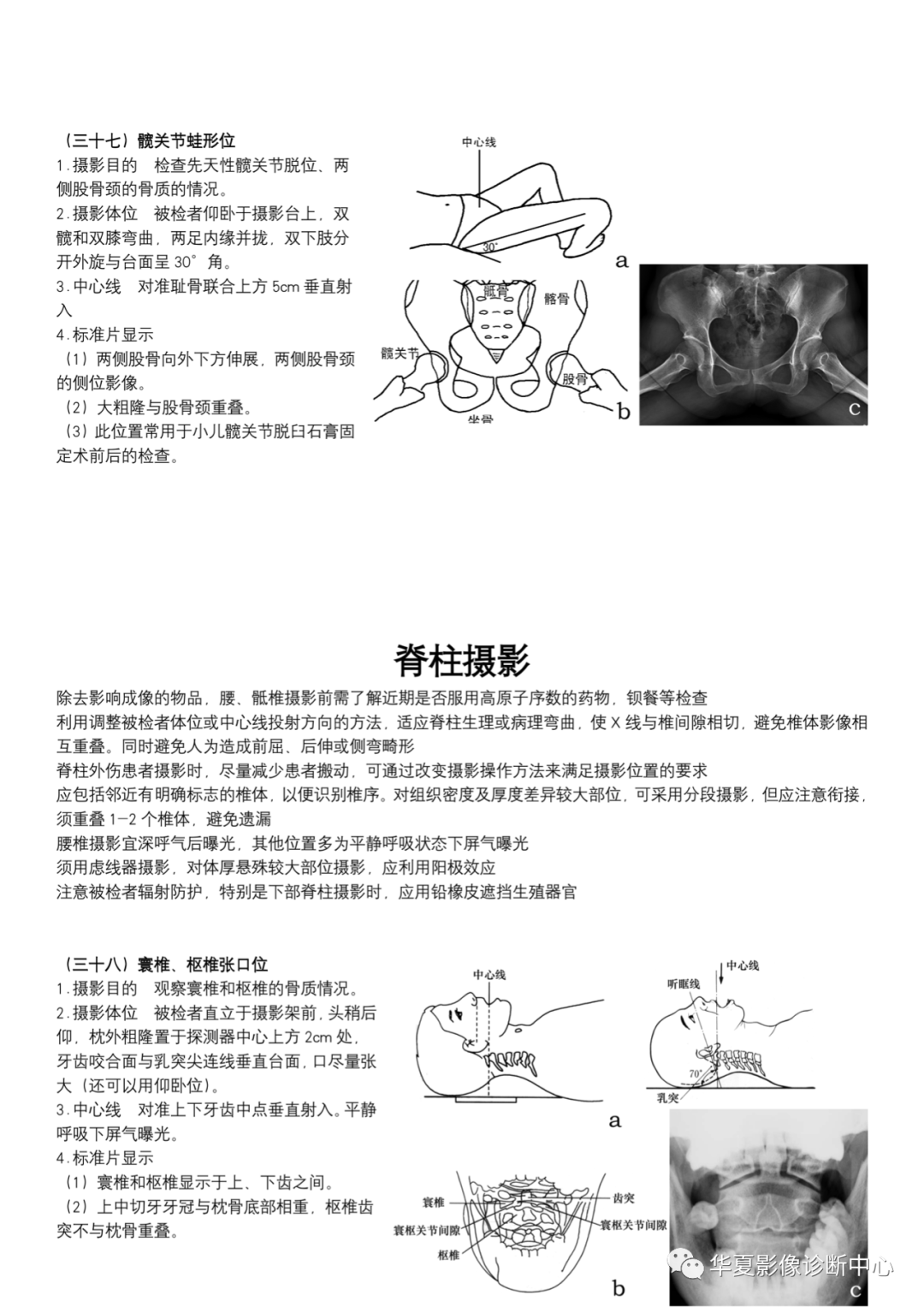 dr摄影是什么DR摄影_https://www.jmylbn.com_新闻资讯_第14张