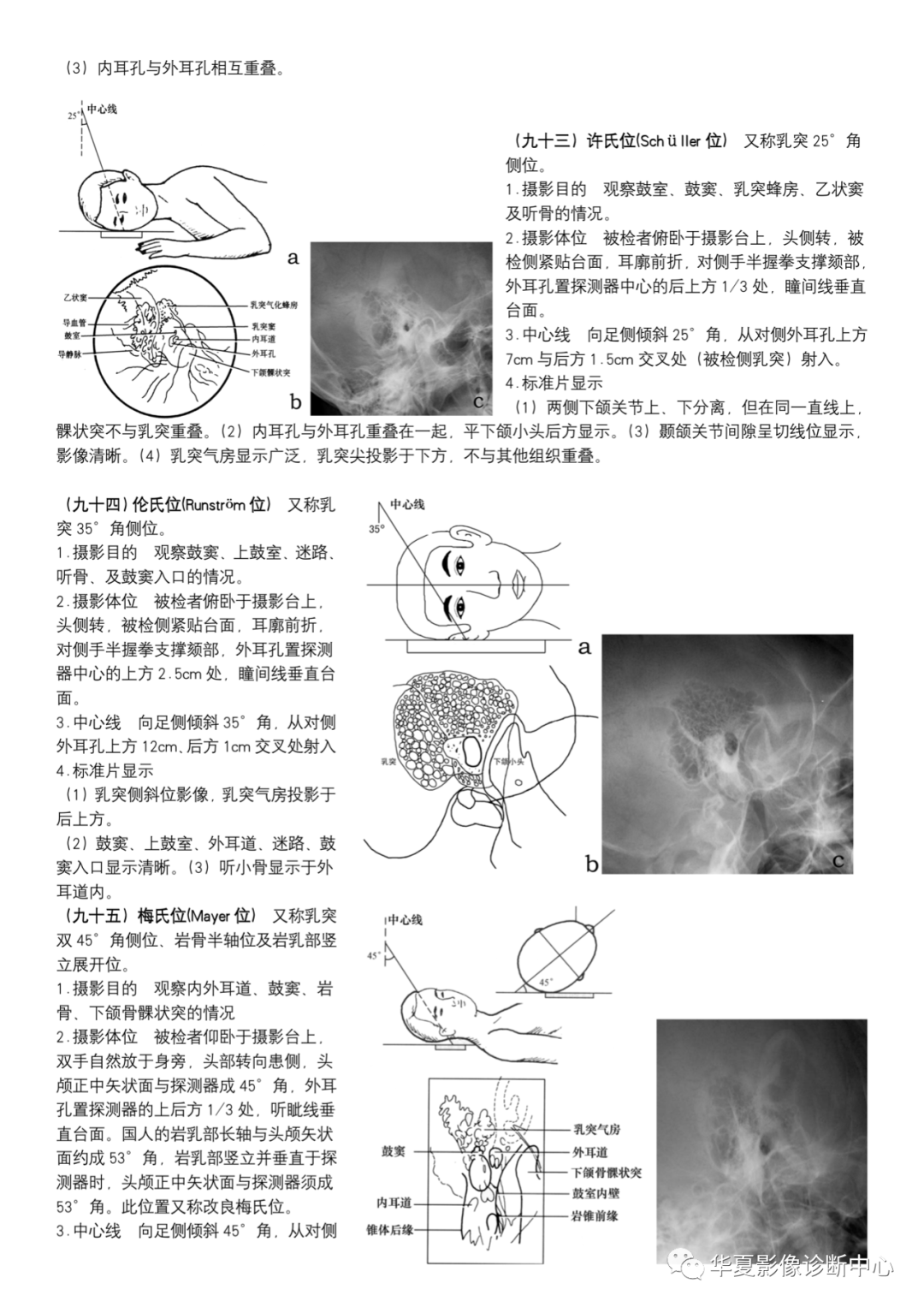 dr摄影是什么DR摄影_https://www.jmylbn.com_新闻资讯_第34张