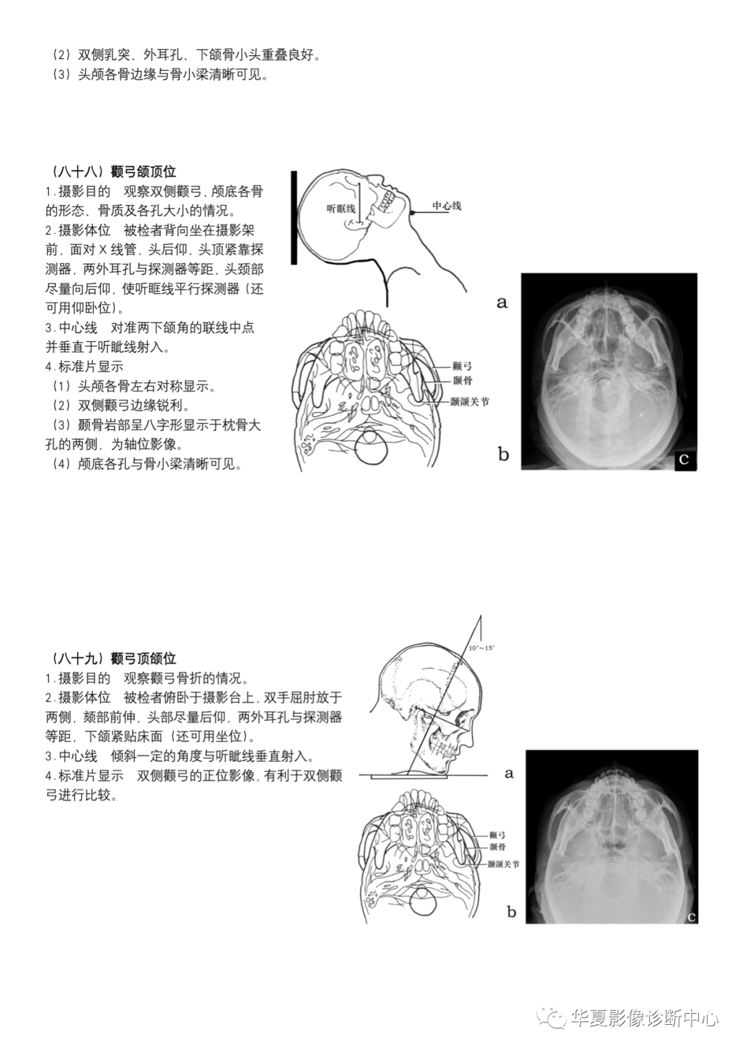 dr摄影是什么DR摄影_https://www.jmylbn.com_新闻资讯_第32张