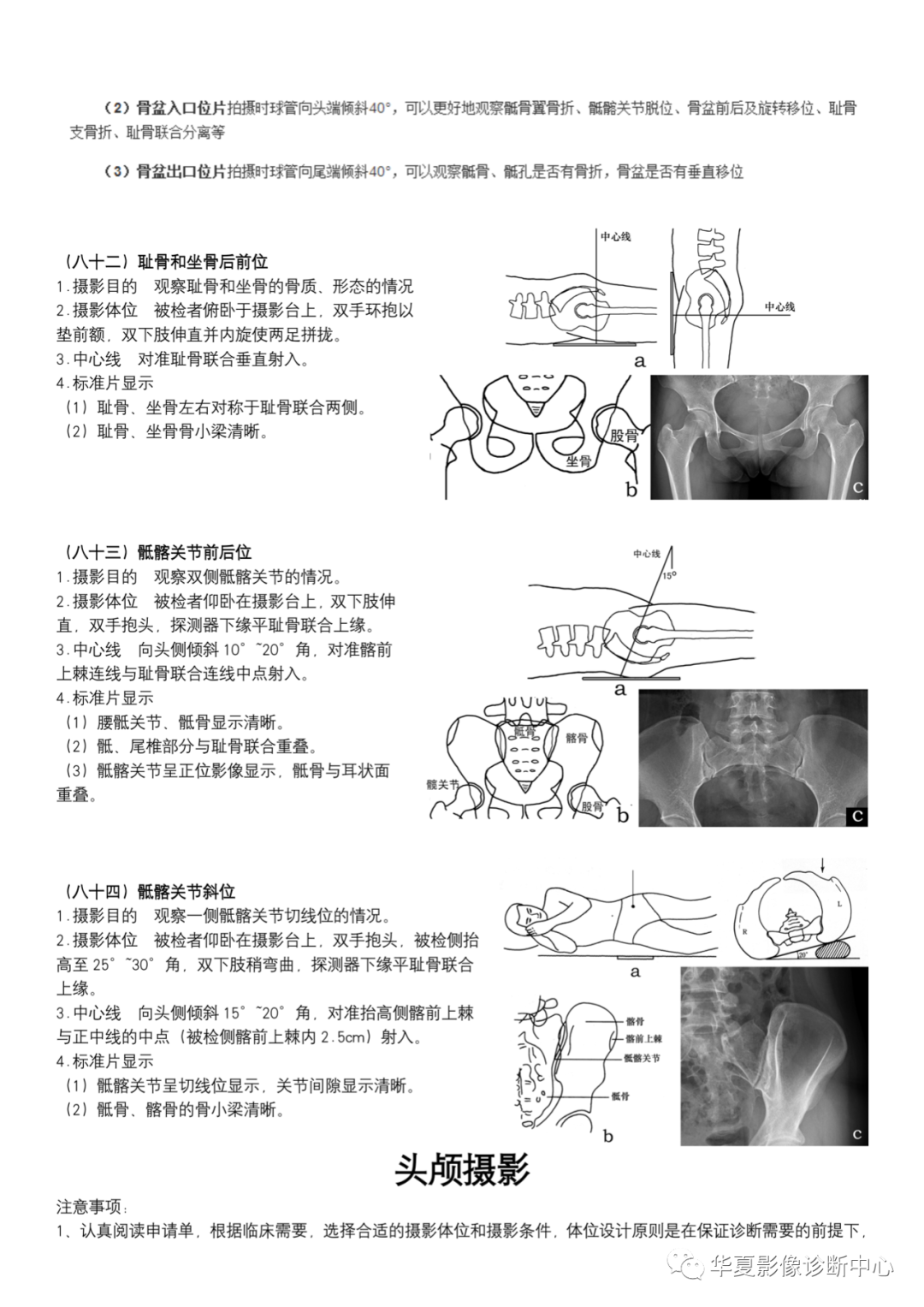 dr摄影是什么DR摄影_https://www.jmylbn.com_新闻资讯_第30张