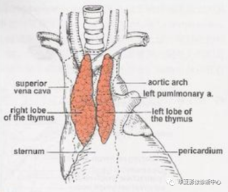 胸腺增生_医学界-助力医生临床决策和职业成长