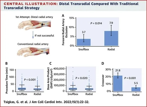动脉什么压迫止血桡动脉压迫时间还能缩短吗？_https://www.jmylbn.com_新闻资讯_第2张