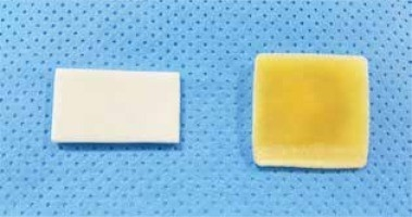 动脉什么压迫止血桡动脉压迫时间还能缩短吗？_https://www.jmylbn.com_新闻资讯_第5张