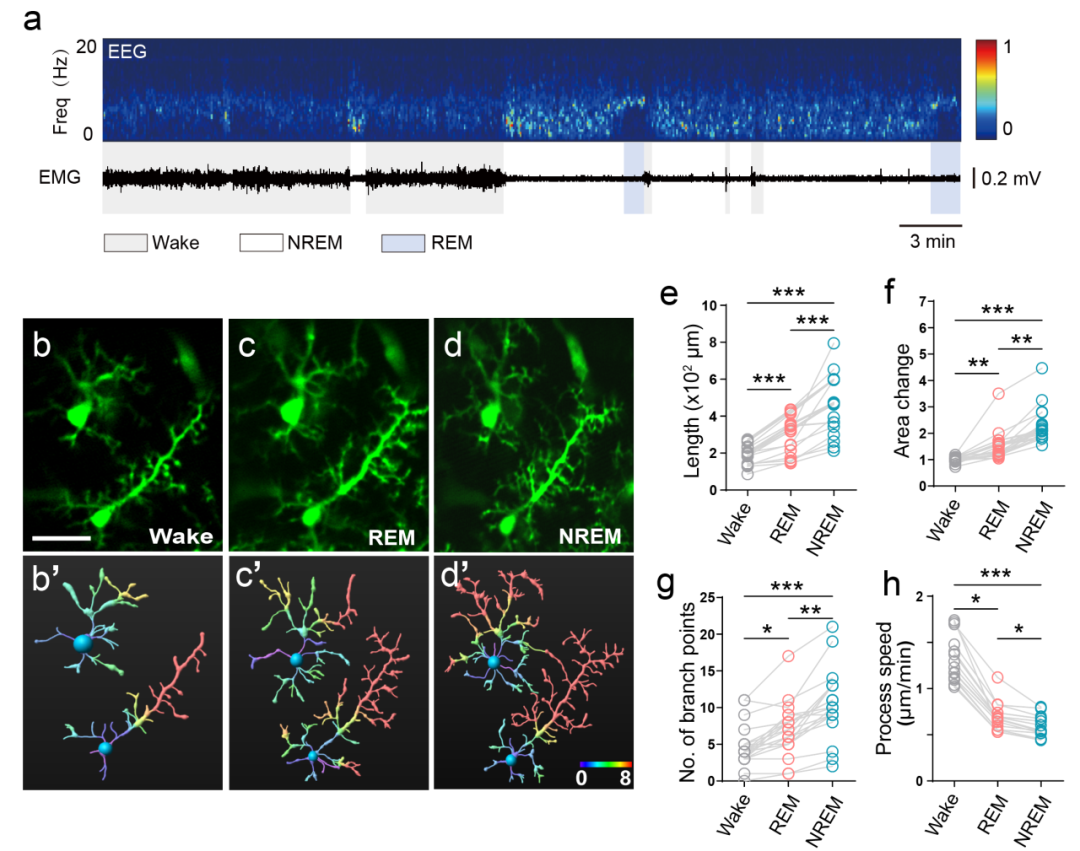 利用微型化雙光子技術(shù)揭示自由睡眠下的小膠質(zhì)細(xì)胞行為與功能