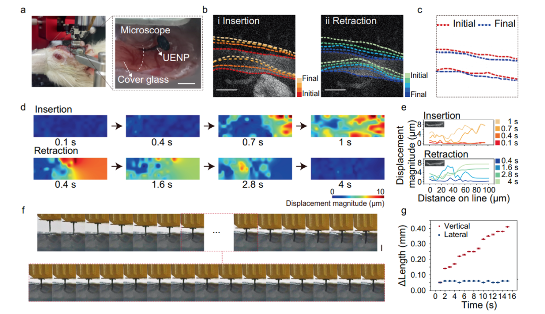 超維景助力南京醫(yī)科大學(xué)胡本慧課題組：防止術(shù)中出血的單軸延伸神經(jīng)電極