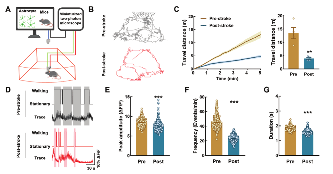 超維景助力東南大學姚紅紅課題組揭示星形膠質(zhì)細胞在缺血性卒中的神經(jīng)機制