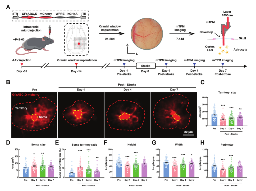 超維景助力東南大學姚紅紅課題組揭示星形膠質(zhì)細胞在缺血性卒中的神經(jīng)機制