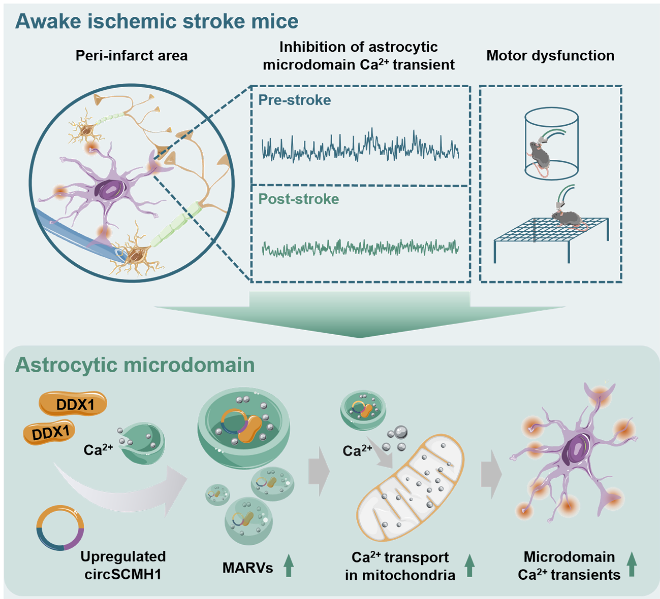 超維景助力東南大學姚紅紅課題組揭示星形膠質(zhì)細胞在缺血性卒中的神經(jīng)機制
